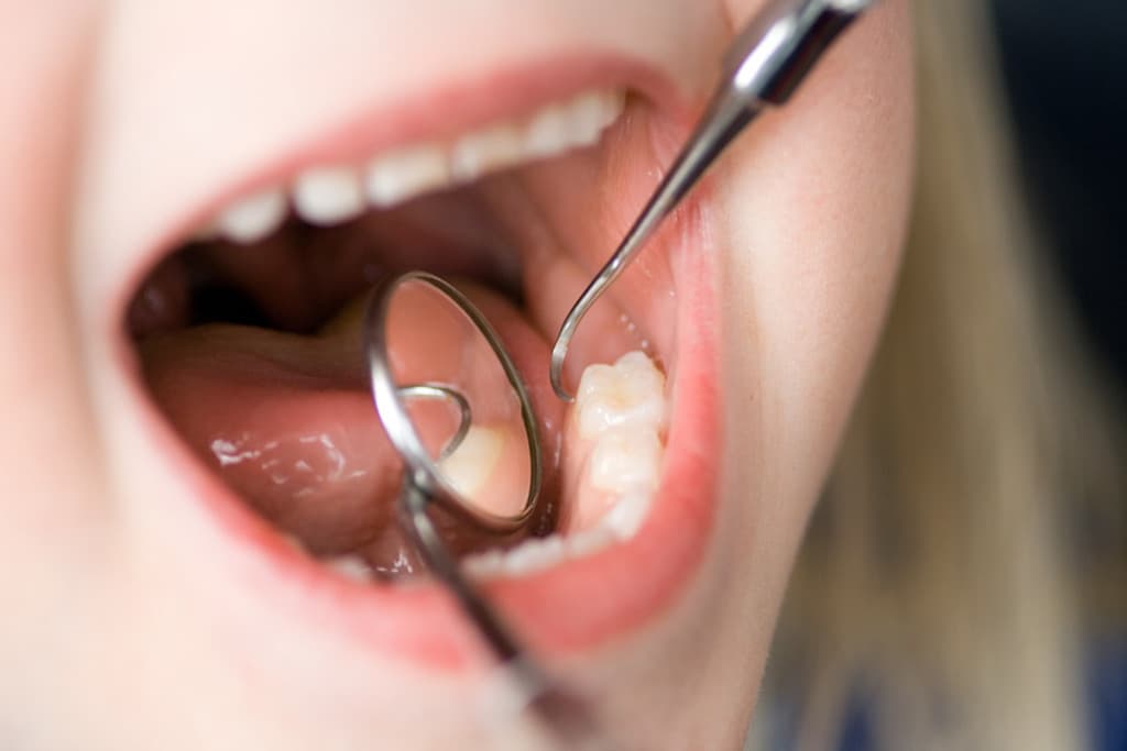 Tu clínica dental en Santiago - Tratamiento integral para tu boca